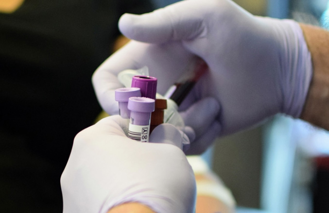 香港试管助孕生子-香港血液测试筛查脆性X综合症