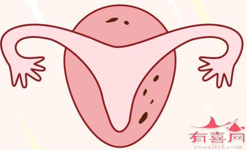 重庆供卵中介高端群：如何判断你的输卵管发育是否正常