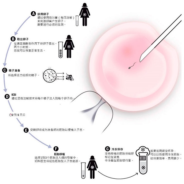遵义40岁a卵b怀：在试管婴儿中是否可以选择移植单个胚胎或多个胚胎？