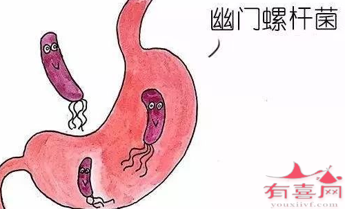 澳门借腹生子40万起-幽门螺杆菌感染的症状是什么，你有感觉吗？